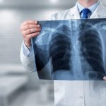 radiologia-e-radiografia